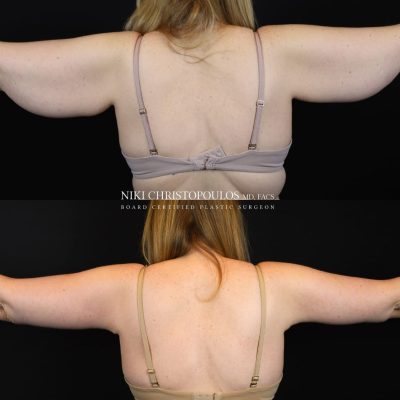 Niki Christopoulos Board Certified Plastic Surgeon (15)A